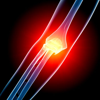 Arthroscopic Debridement of the Elbow Arthroscopic Debridement of the Elbow